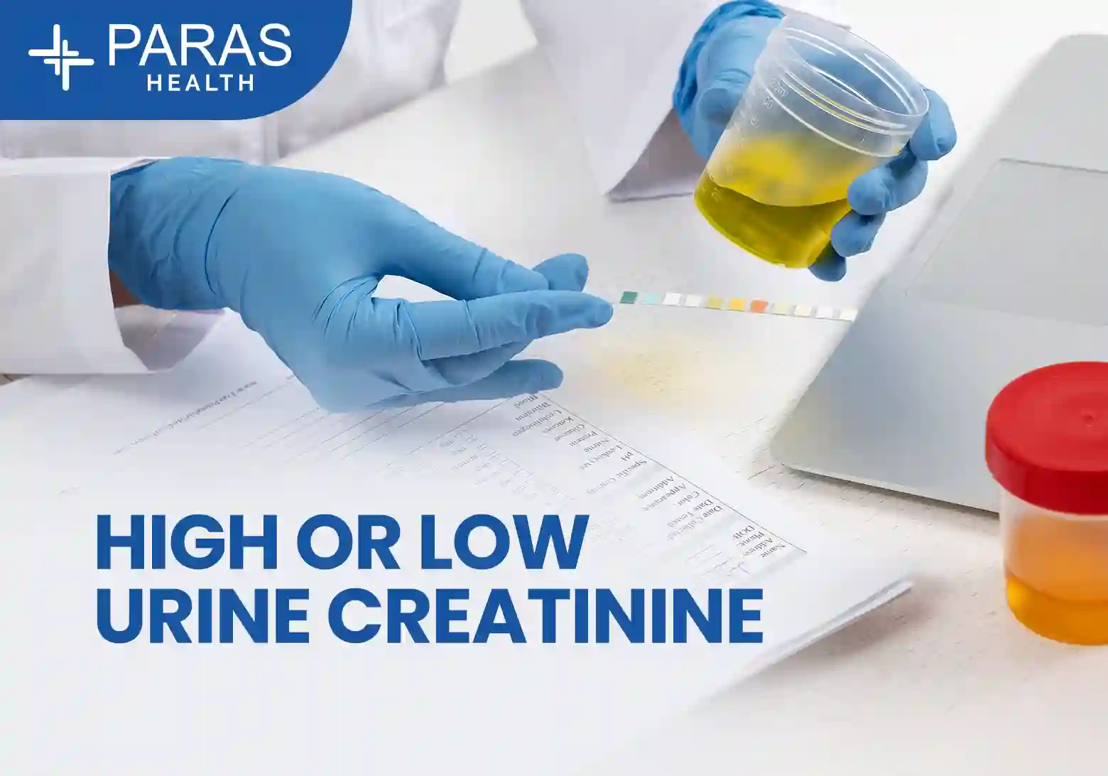 High and Low Urine Creatinine Levels: Causes, Symptoms, Test, and Treatment